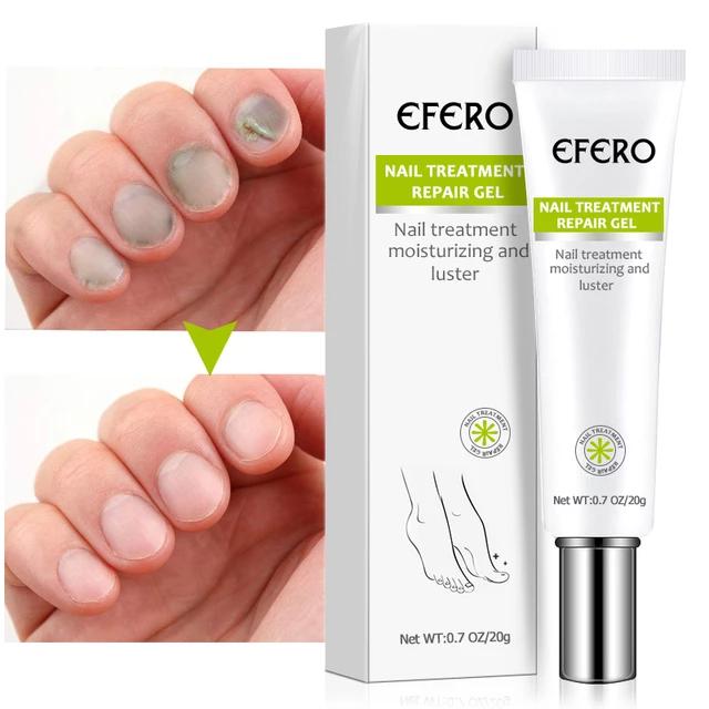 EFERO:"Des ongles sain et forts"
