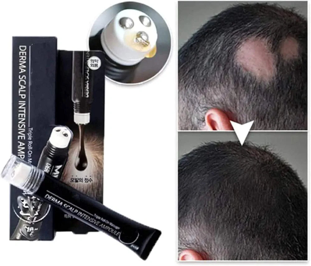 Serum de repousse de cheveux