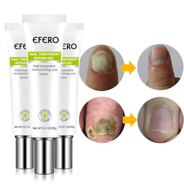 EFERO:"Des ongles sain et forts"