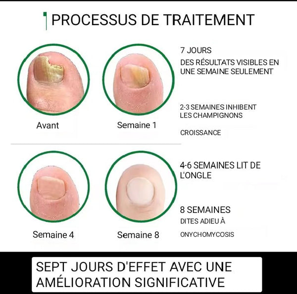 EFERO:"Des ongles sain et forts"