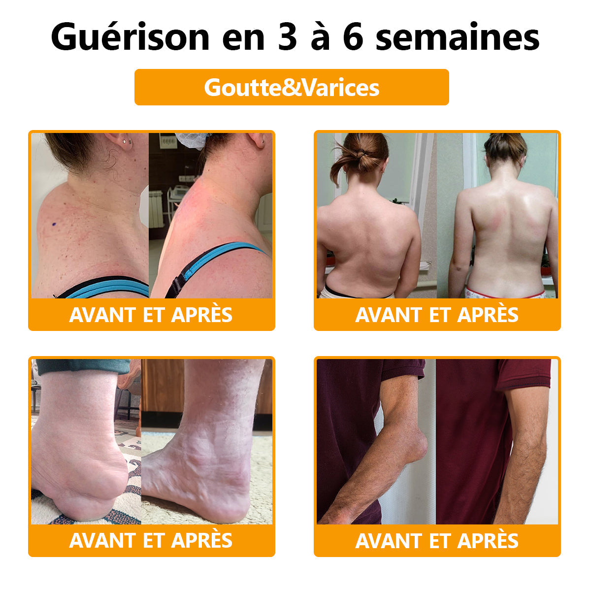 Crème de Soulagement Avancé