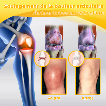Crème de Soulagement Avancé