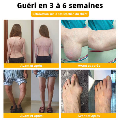 Crème de Soulagement Avancé