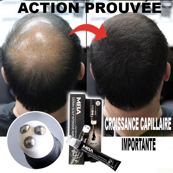 Serum de repousse de cheveux