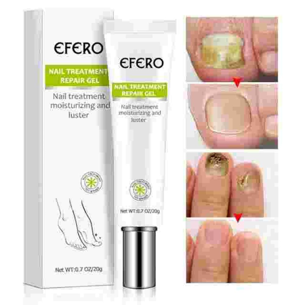EFERO:"Des ongles sain et forts"