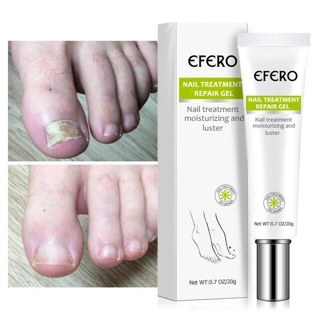 EFERO:"Des ongles sain et forts"