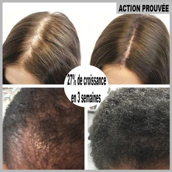 Serum de repousse de cheveux